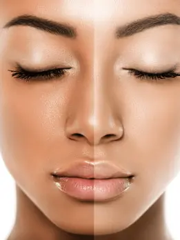 Lighter complexion